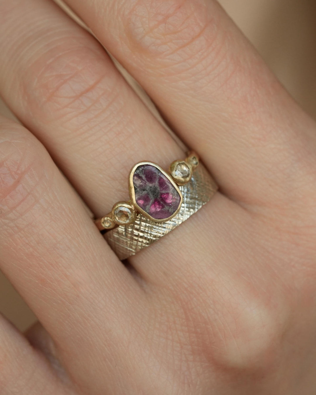 Trapiche Ruby and Diamond Ring