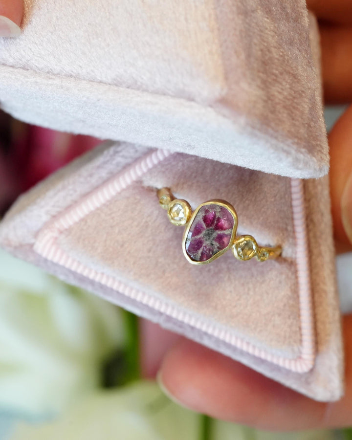 Trapiche Ruby and Diamond Ring