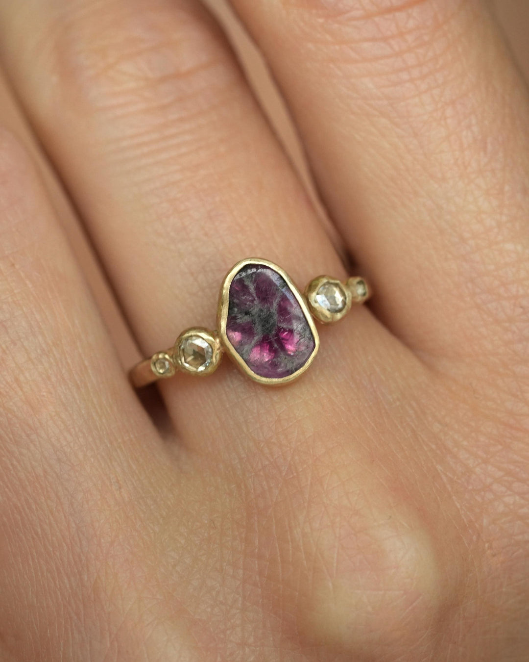 Trapiche Ruby and Diamond Ring