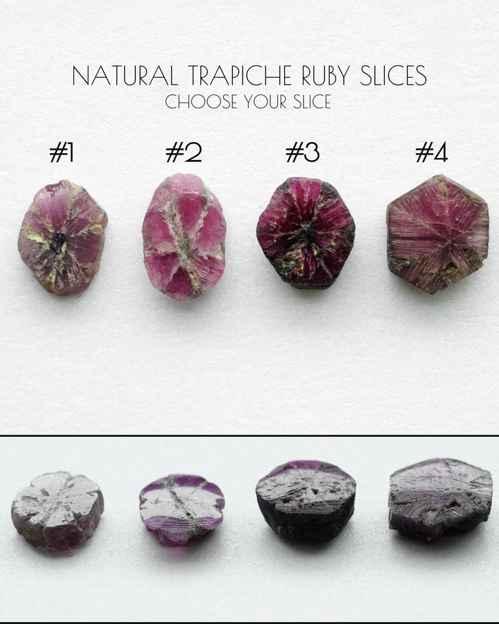 Trapiche Ruby Ring